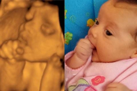 胎儿四维照很丑，生出来也会很丑？这六张图告诉你答案，太真实了